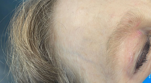 Sea weed Facial in NY