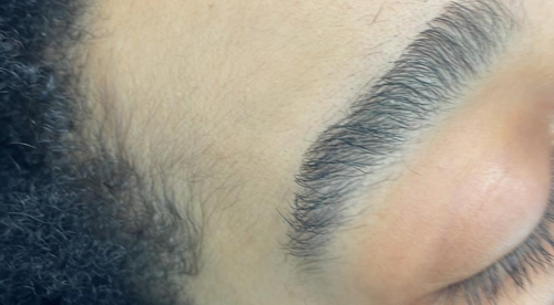 Full Back Facial in NY